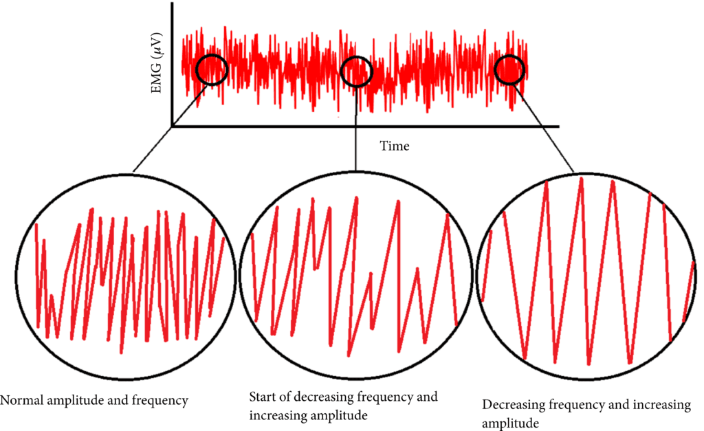EMG e valutazione ergonomica
Panahi & Cho, 2016