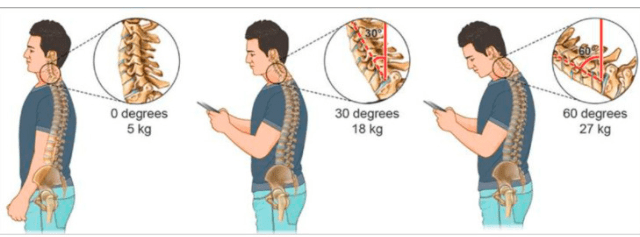 Illuminazione e postura